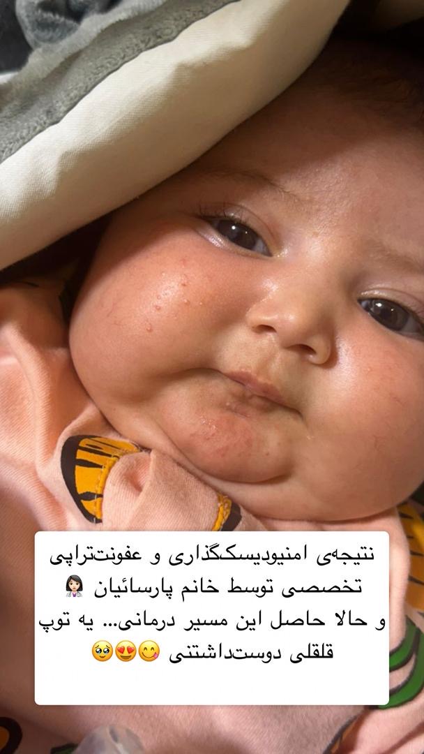 امنودیسکگذاری و عفونت تراپی در اندیمشک توسط ماما سمیه پارسائیان