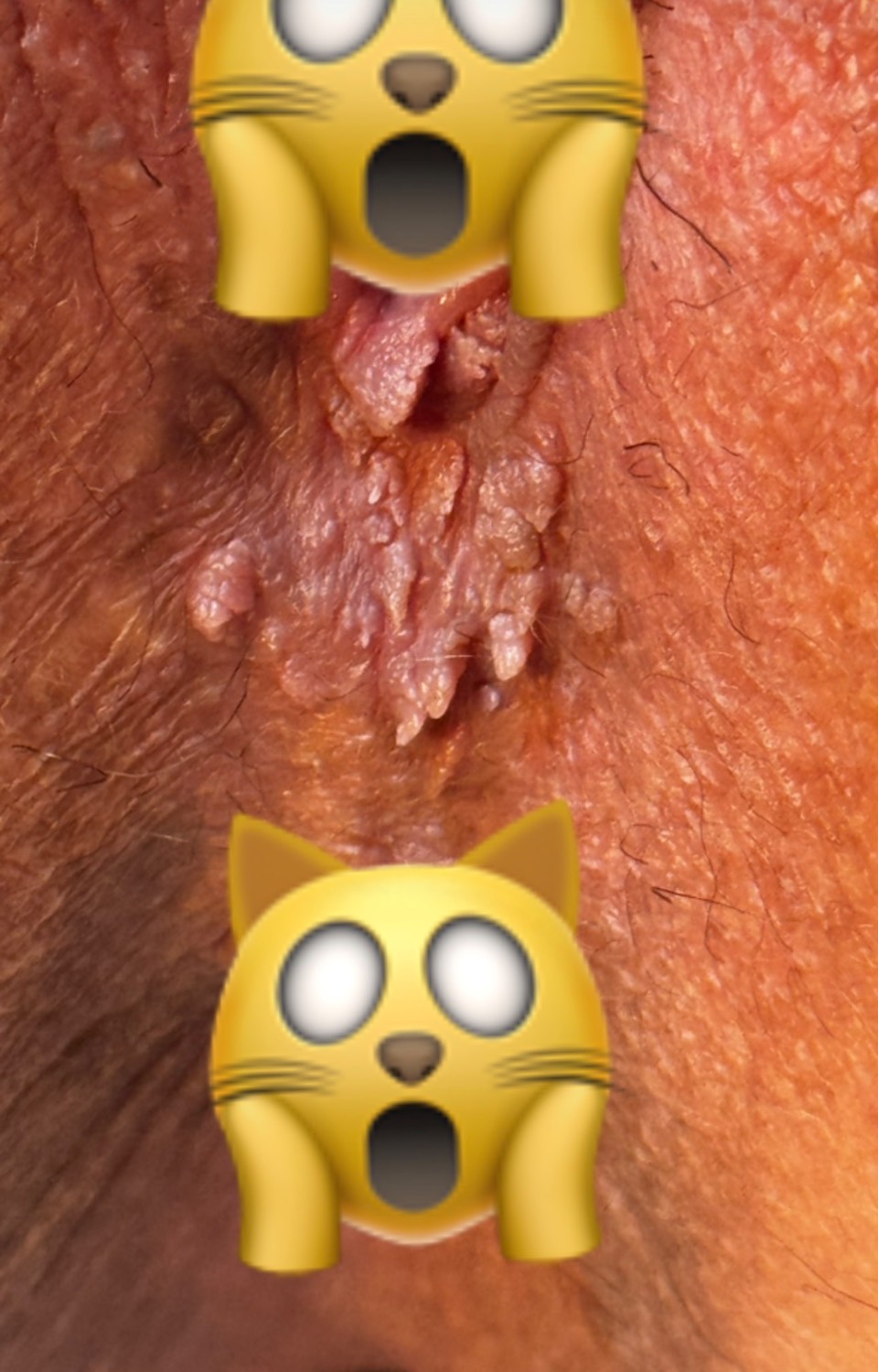 HPV و واکسن HPV  | ماما سمیه پارسائیان در اندیمشک